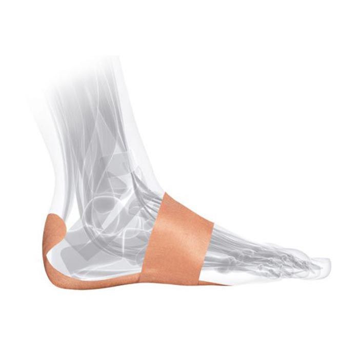 Mueller Plantar Fascitis PF Tape System For